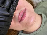 &