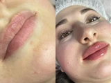 &
