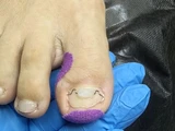 &