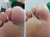&