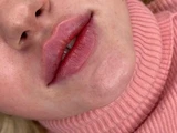 &