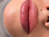 &