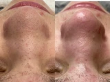 &