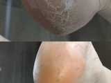 &