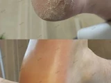 &