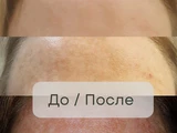 &