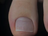&