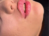 &