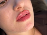 &