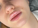 &