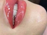 &