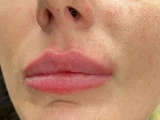 &