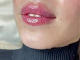&