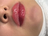 &