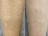 &