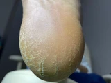 &