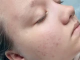 &