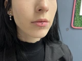 &