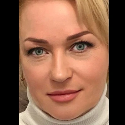 Альбина