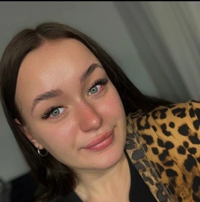 Альбина