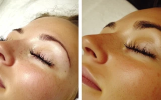 Комплекс: наращивание ресниц 2D и наращивание нижних ресниц